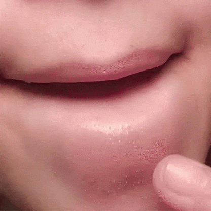 Dr. Elarin™ Serum